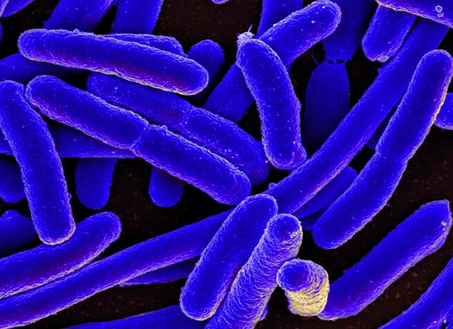 E. coli verursacht sehr häufig die Entwicklung einer Blasenentzündung bei Frauen
